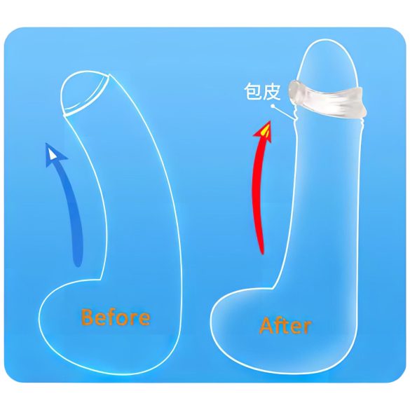 Anneau gland en silicone - retardateur éjaculation - transparent